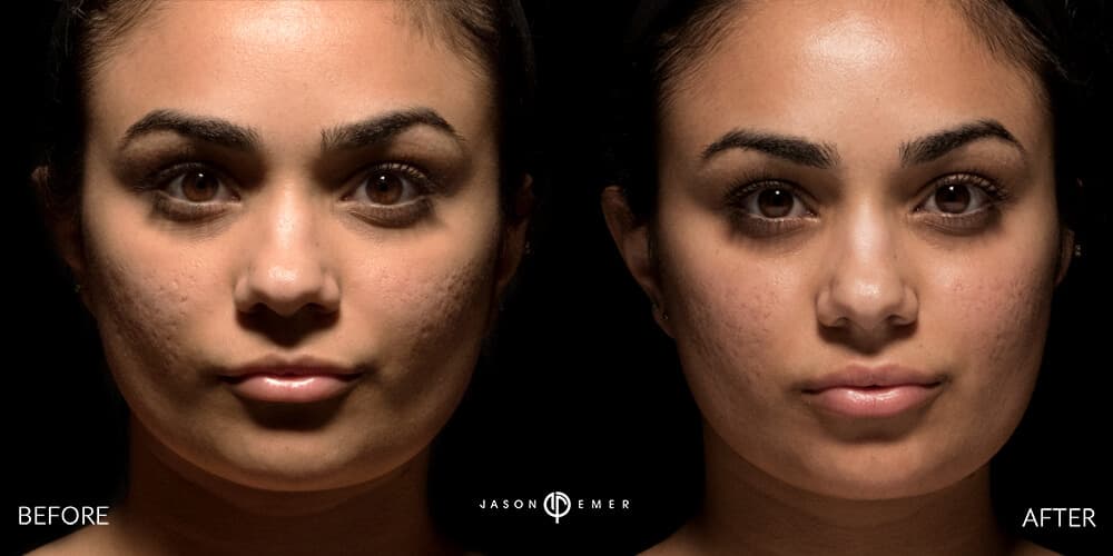 Patient before and after