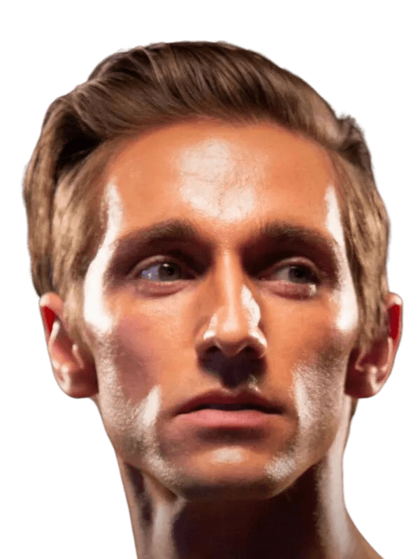 Facelift for Men