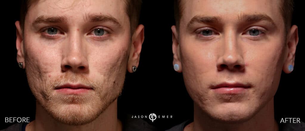 Patient before and after