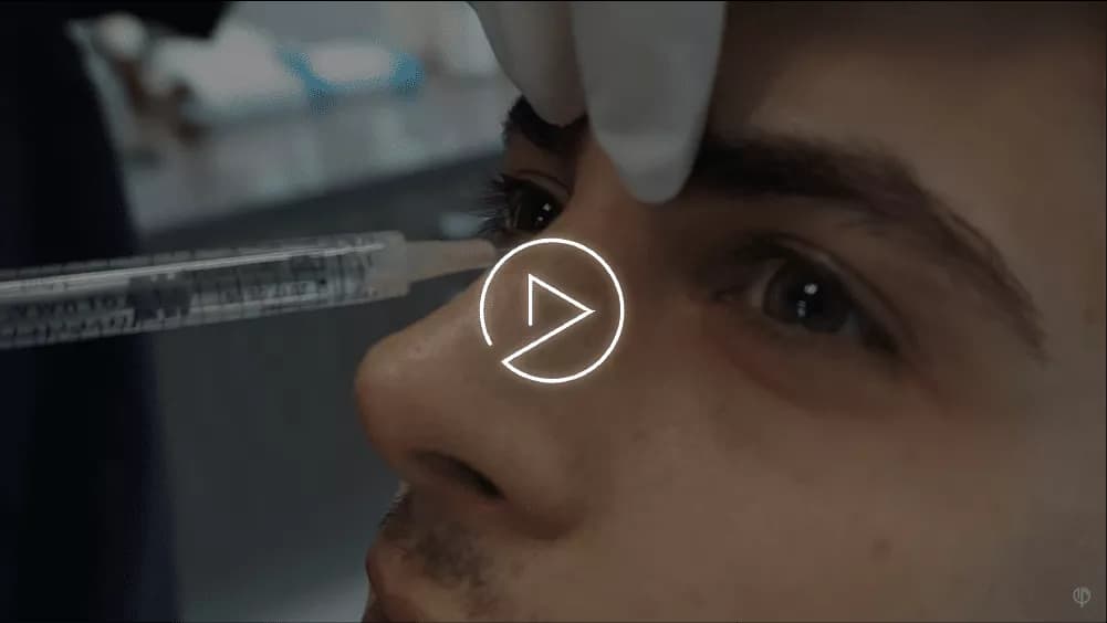 Non-surgical Rhinoplasty