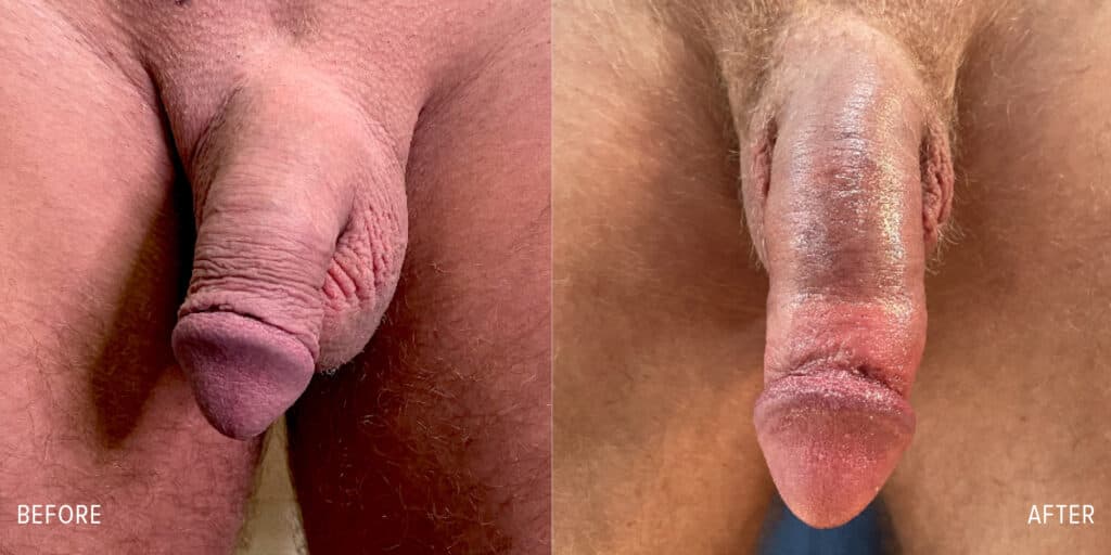 Patient before and after
