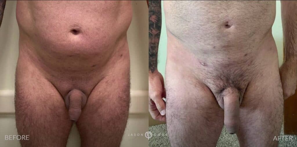 Patient before and after