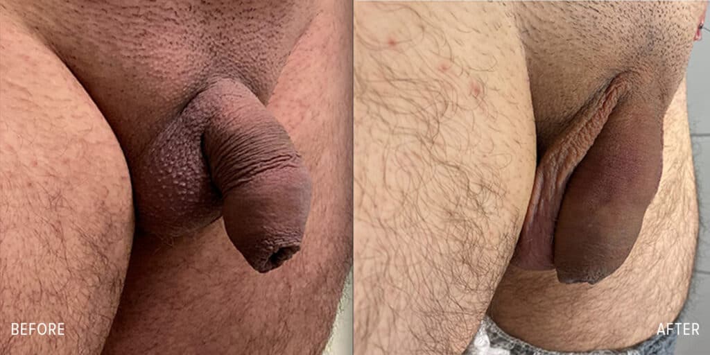 Patient before and after