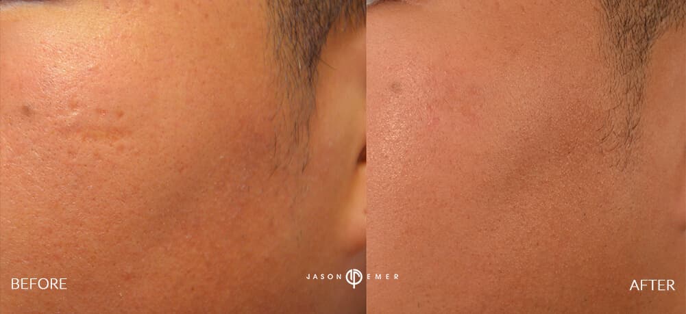 Patient before and after