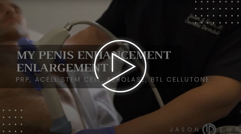 Shockwave Therapy