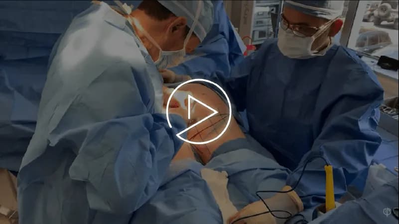 Thigh Lift & Tightening For Women