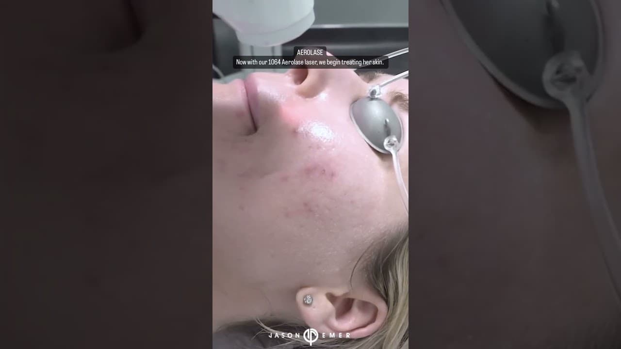 Watch a abdominal lipo for women procedure video