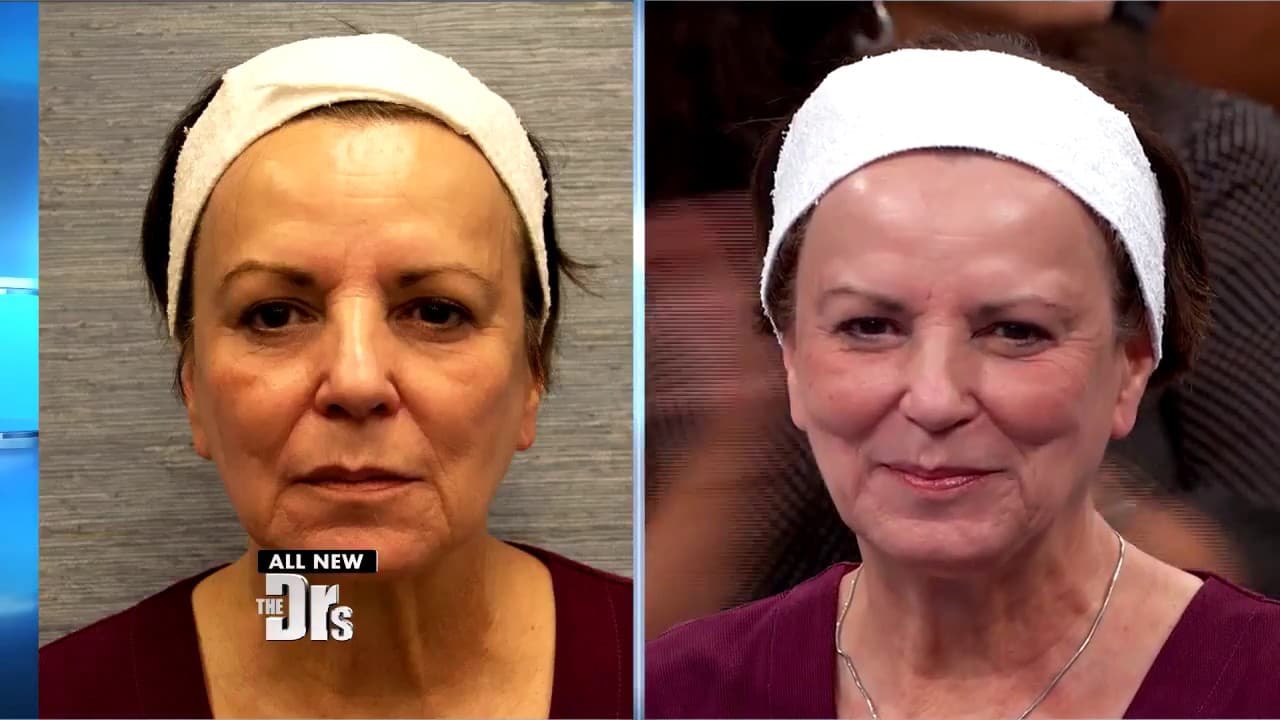 Patient story video 5