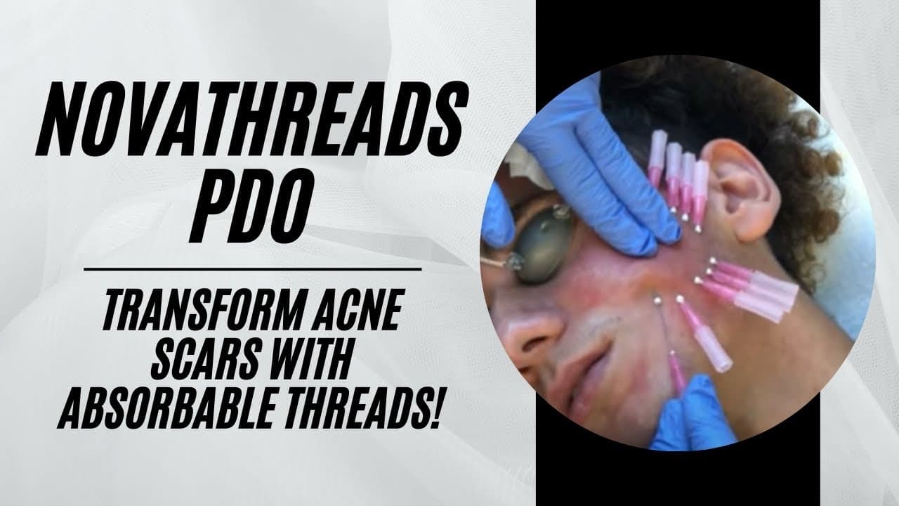 Watch a lip enhancement procedure video
