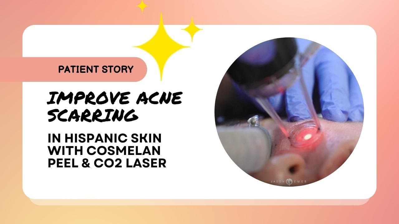CO2 Laser Resurfacing procedure video