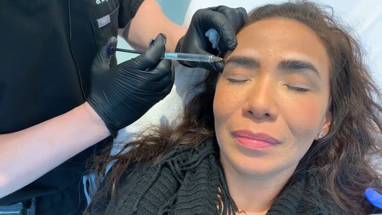 Watch a non-surgical eyelid and brow rejuvenation procedure video