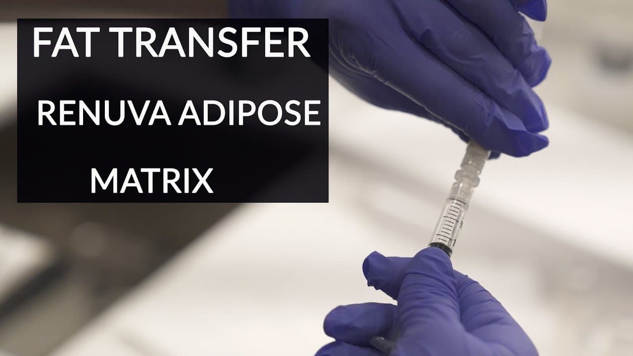 Watch a renuva procedure video