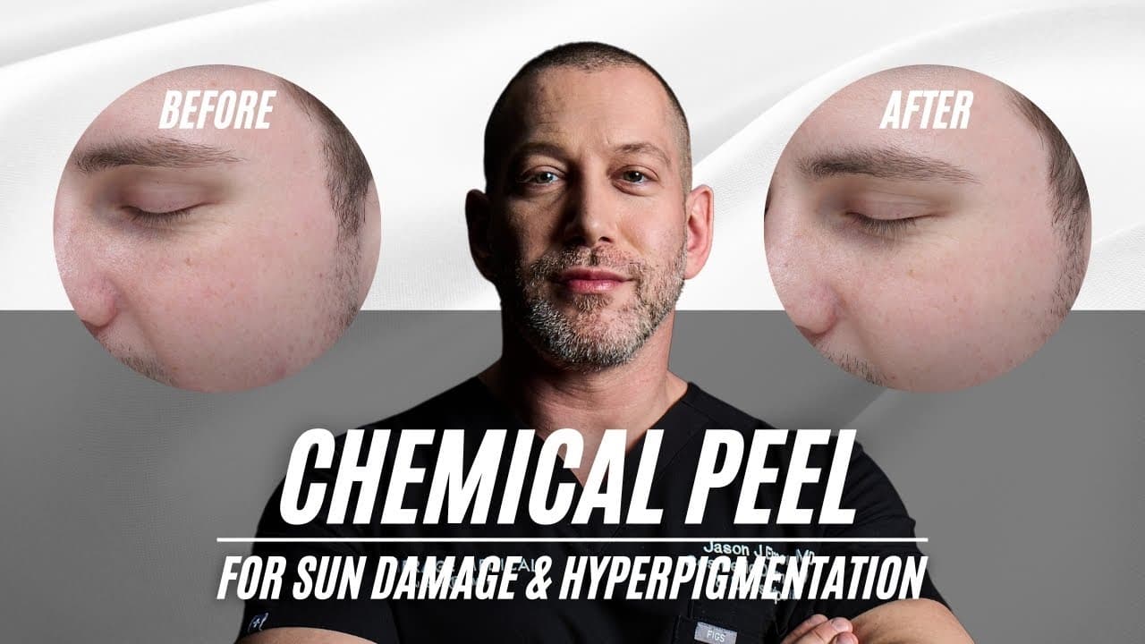Watch a dermaplaning procedure video