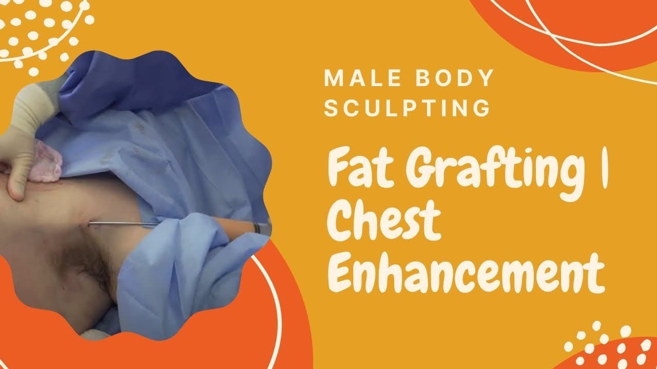 Watch a autologous fat grafting provides permanent volumization, shaping, sculpting, and muscular definition enhancements procedure video