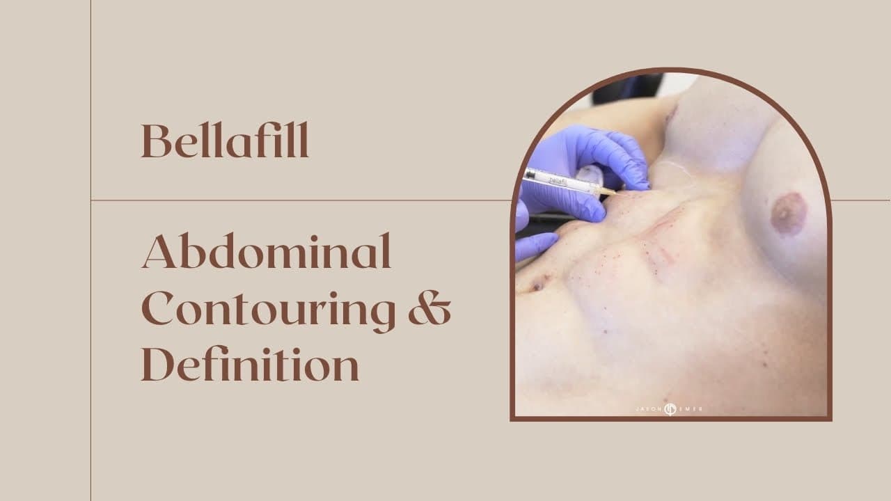 Watch a abdominal lipo for men procedure video