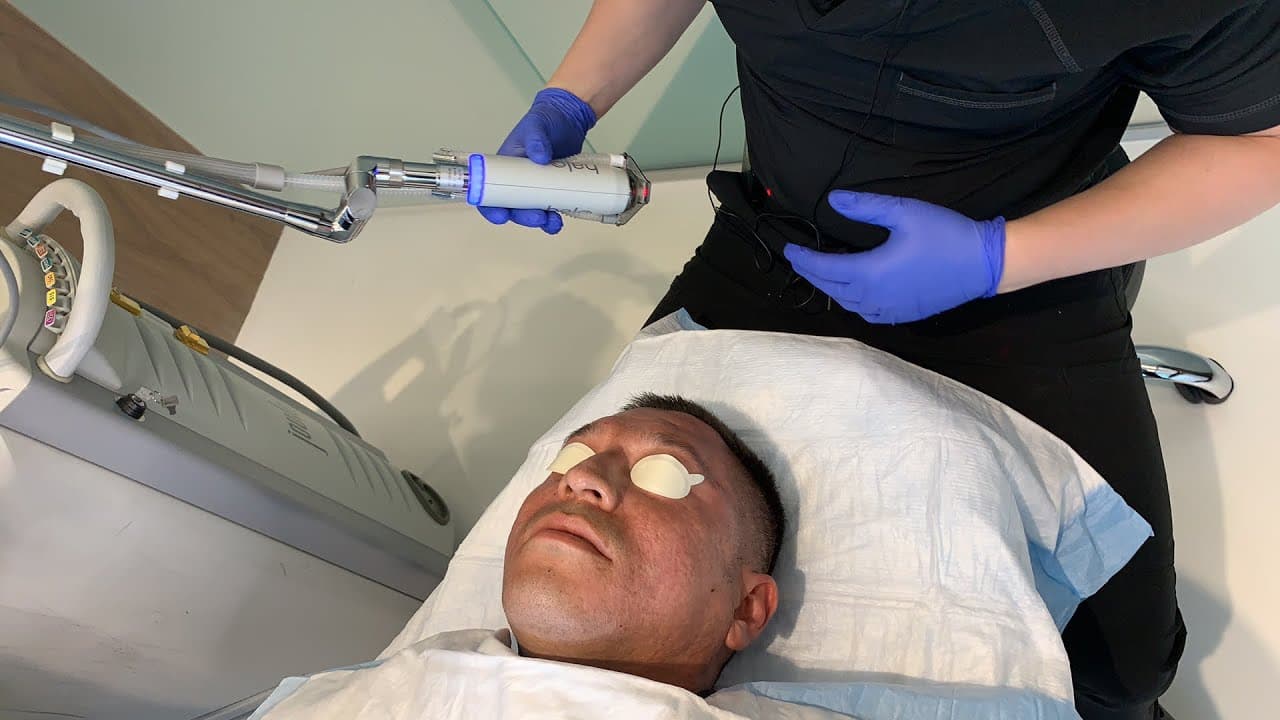 Watch a revolutionary hybrid halo laser procedure video