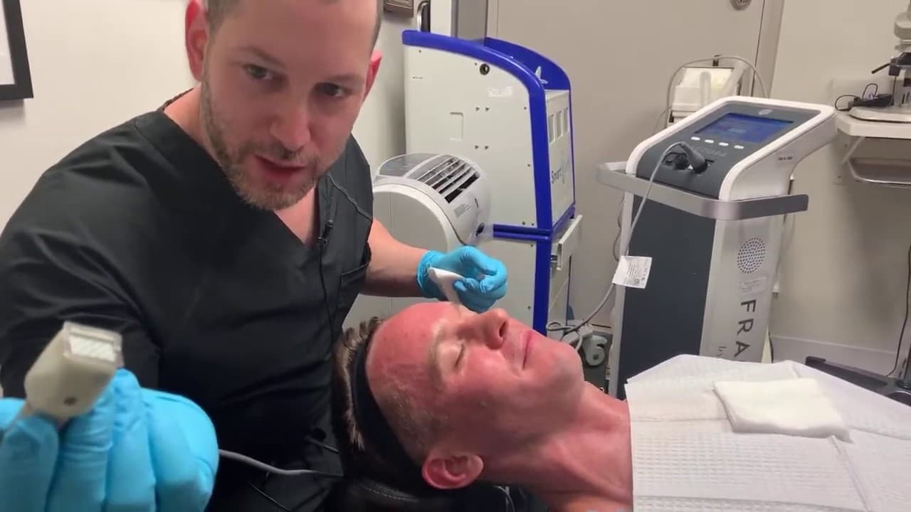 Watch a fractora skin remodeling procedure video
