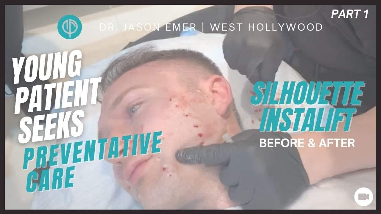 Watch a collagen stimulators procedure video