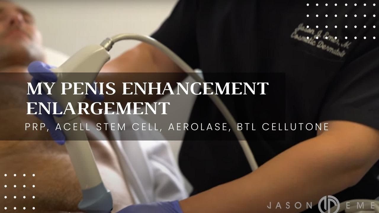 Watch a shockwave therapy procedure video