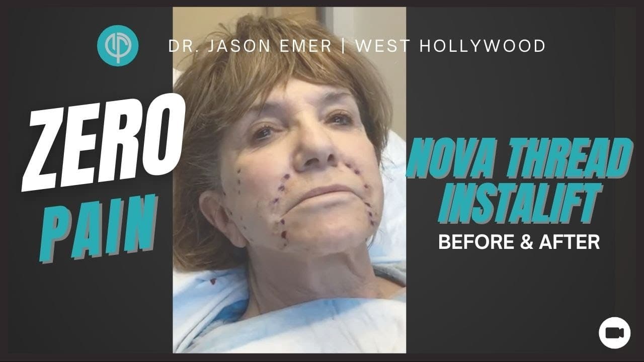 Patient story video 1