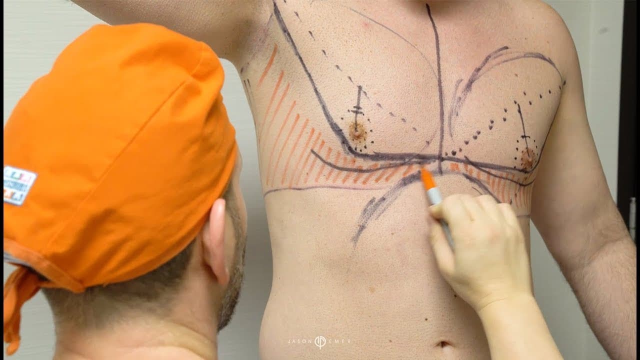 Patient story video 4