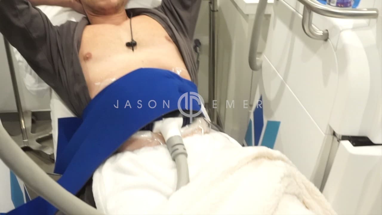 Watch a non-surgical fat reduction & skin tightening procedure video