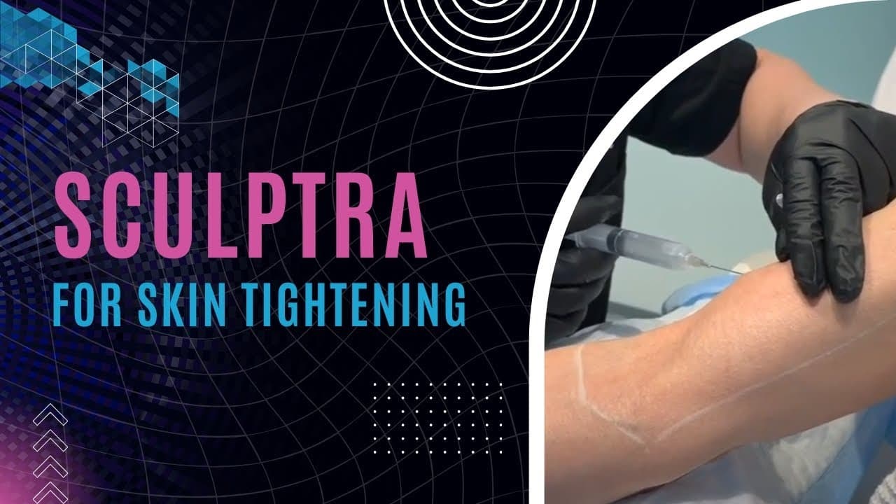 Watch a sculptra procedure video