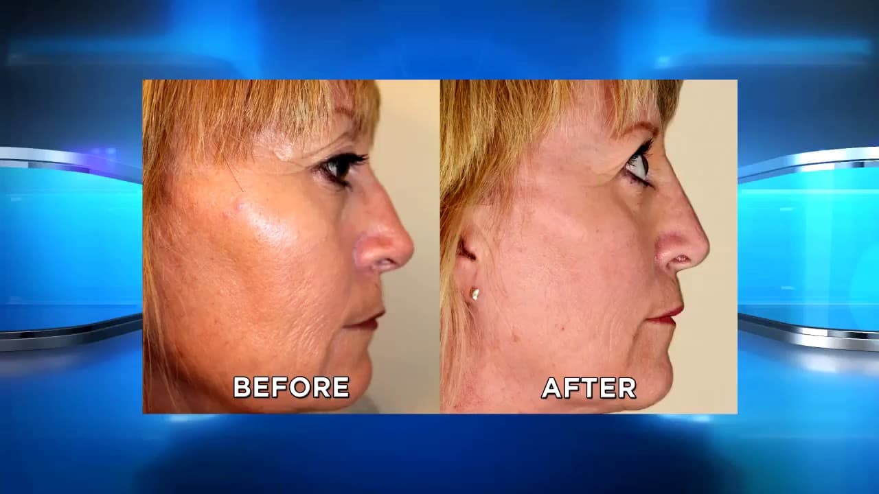 Patient story video 8