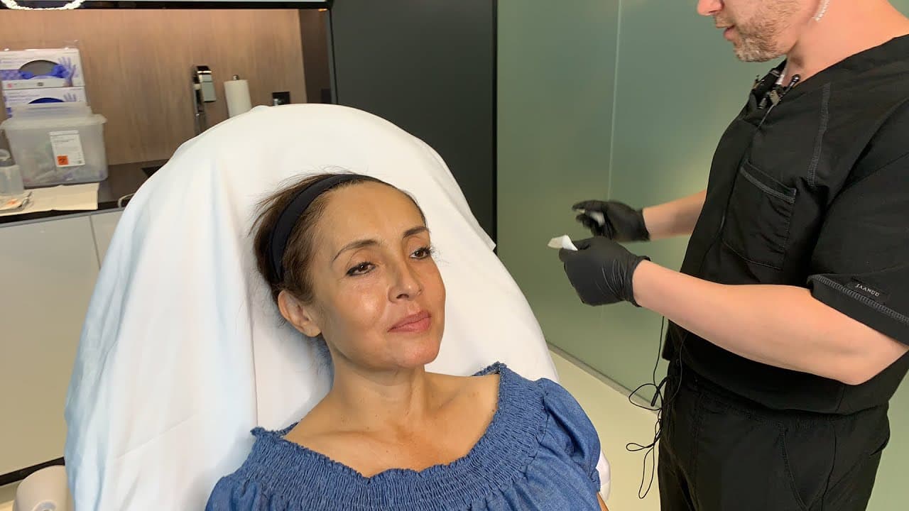 Watch a sculptra procedure video