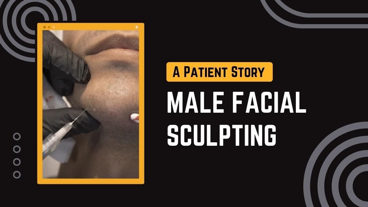Watch a vampire facial procedure video