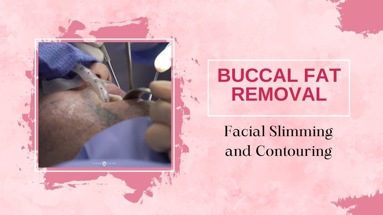 Watch a buccal fat removal for men procedure video