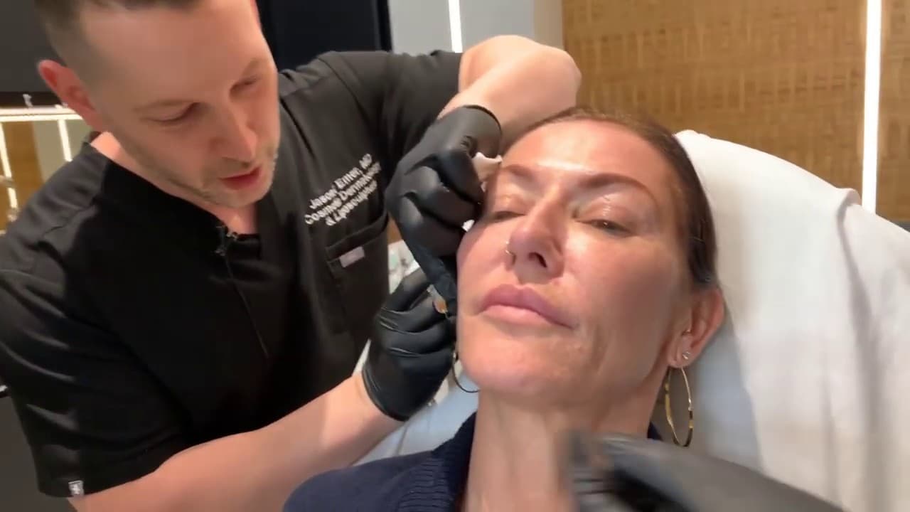 Watch a collagen stimulators procedure video