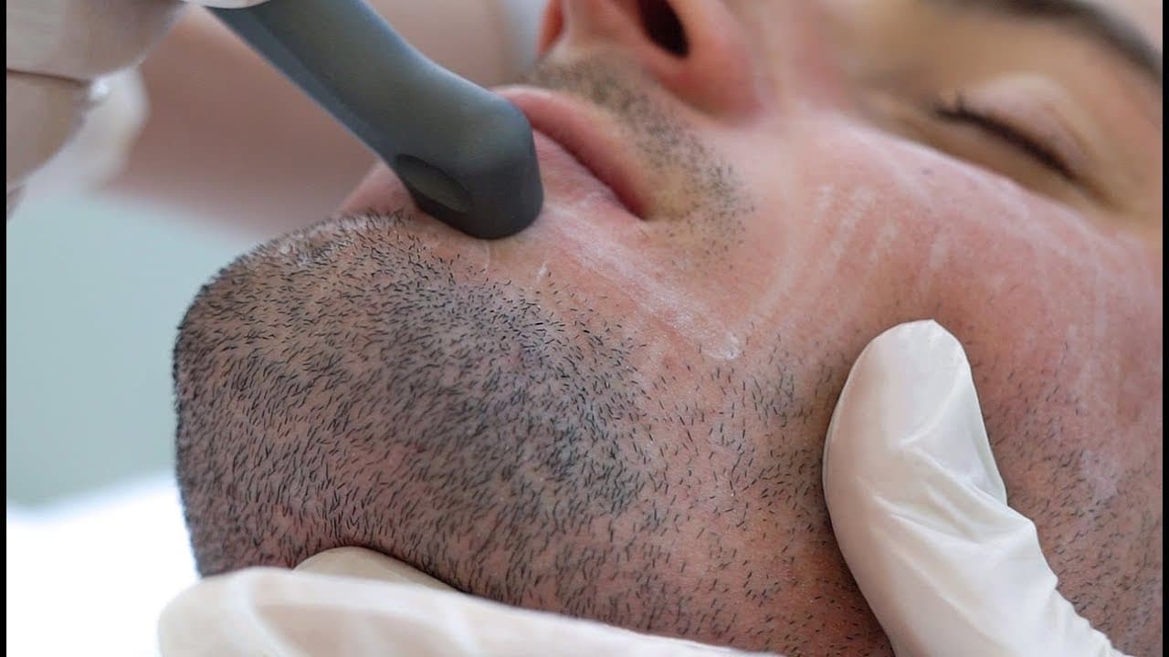 Patient story video 3