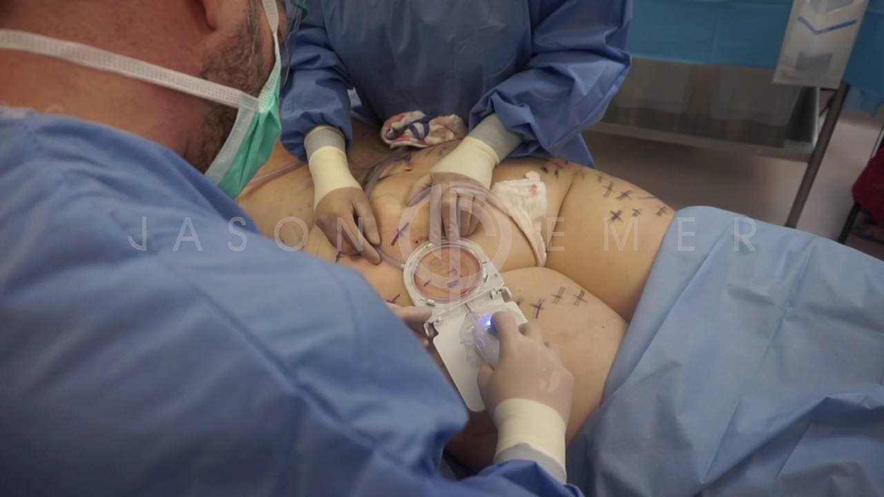 Patient story video 4