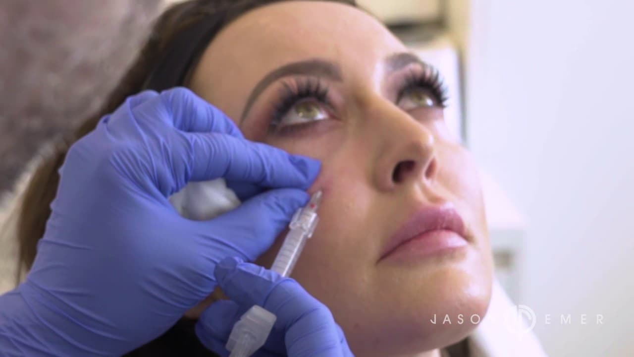 Watch a rejuvenate with injectable fillers procedure video