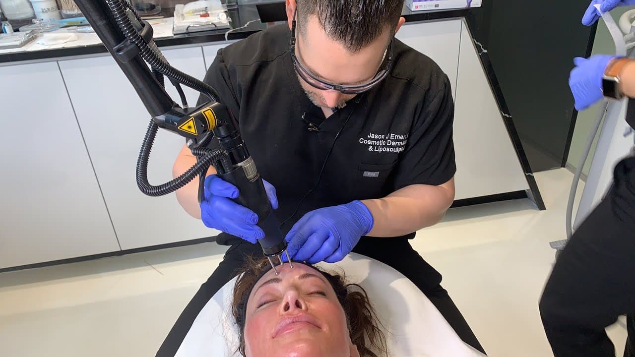 Watch a aging skin & sun spots procedure video