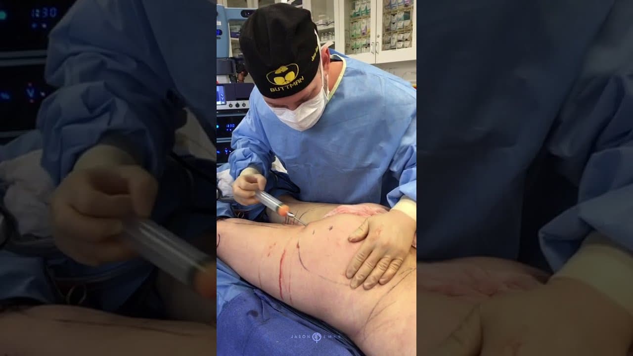 Patient story video 2
