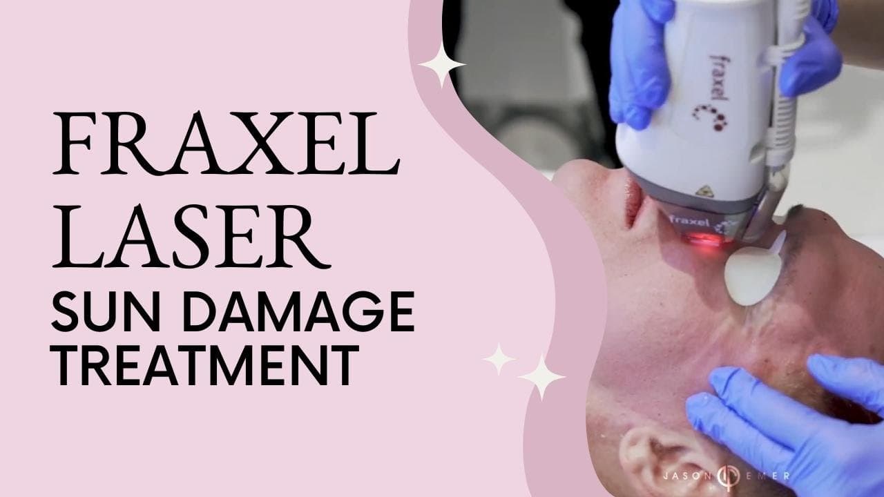 Watch a aging skin & sun spots procedure video