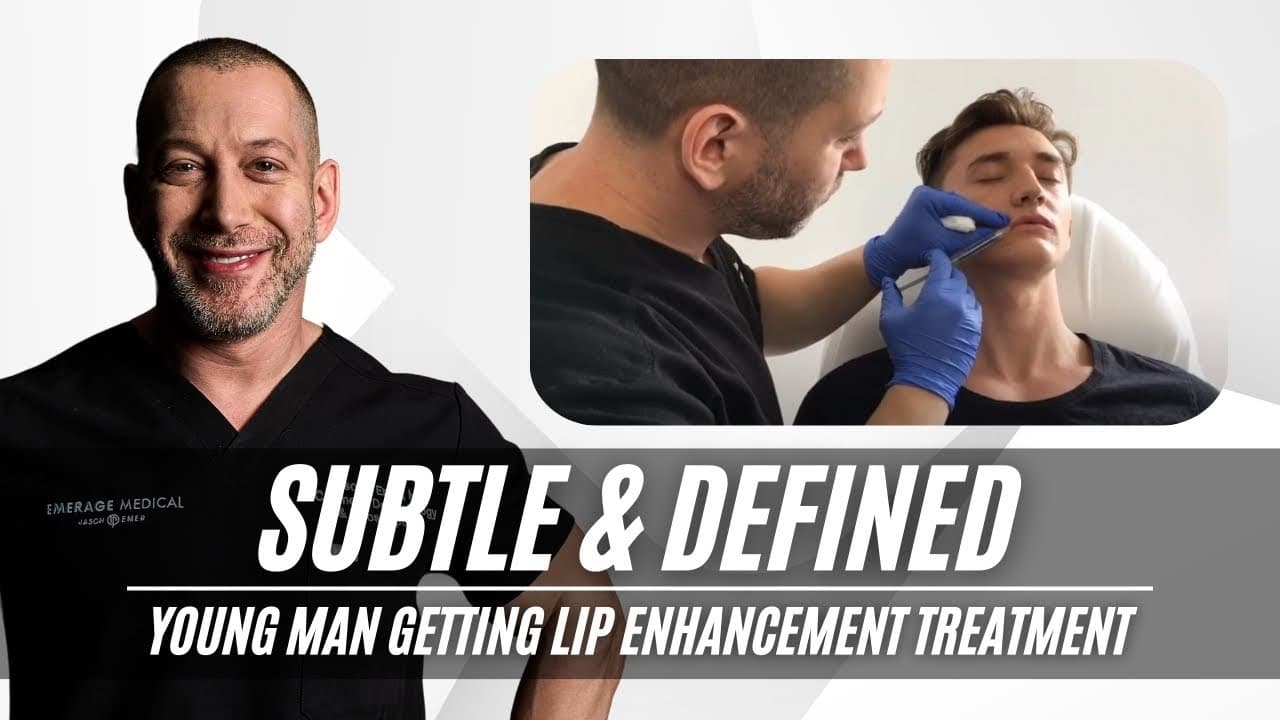 Surgical Lip Lift procedure video