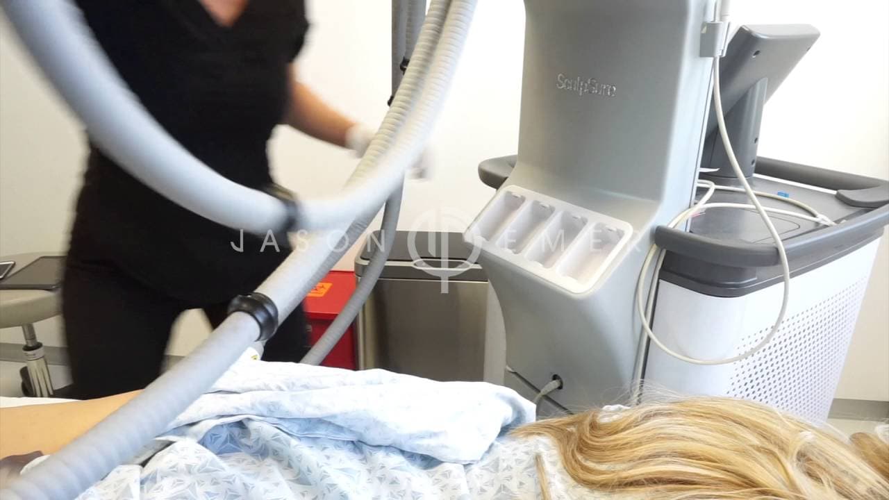 Watch a non-surgical fat reduction & skin tightening procedure video