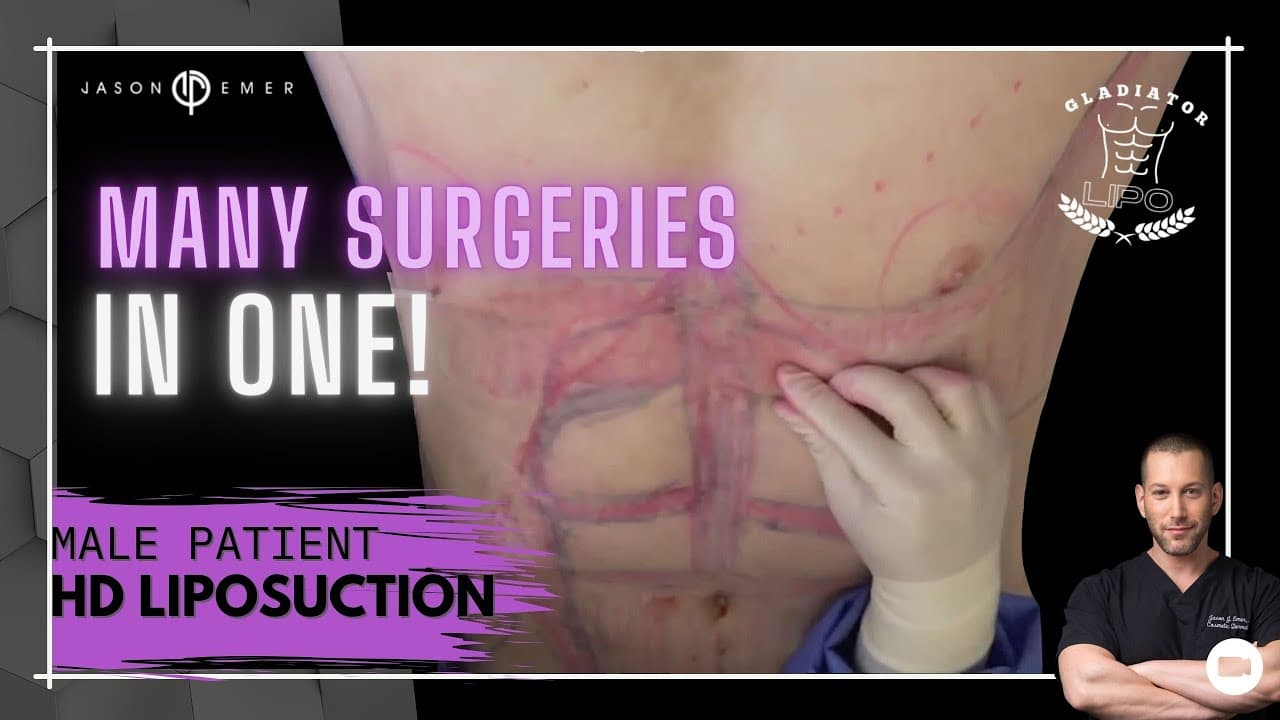 Patient story video 3