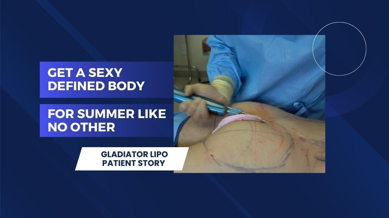 Watch a non surgical butt lift procedure video