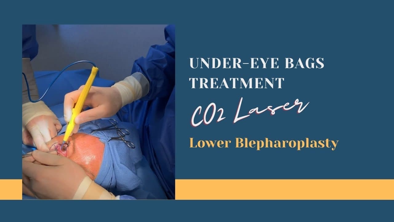 Watch a rejuvenate with injectable fillers procedure video