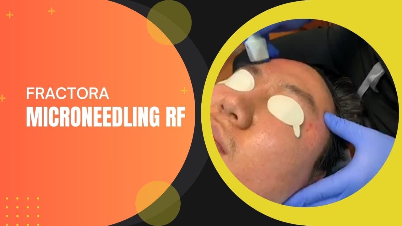Patient story video 9