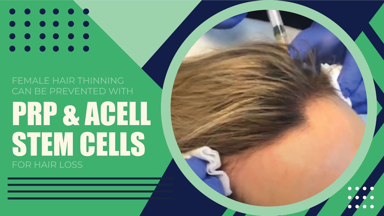 Watch a regenerative medicine & stem cell therapy procedure video