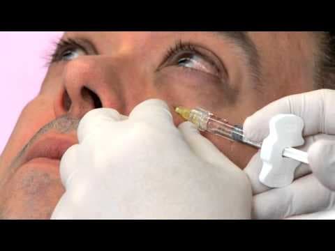 Watch a rejuvenate with injectable fillers procedure video