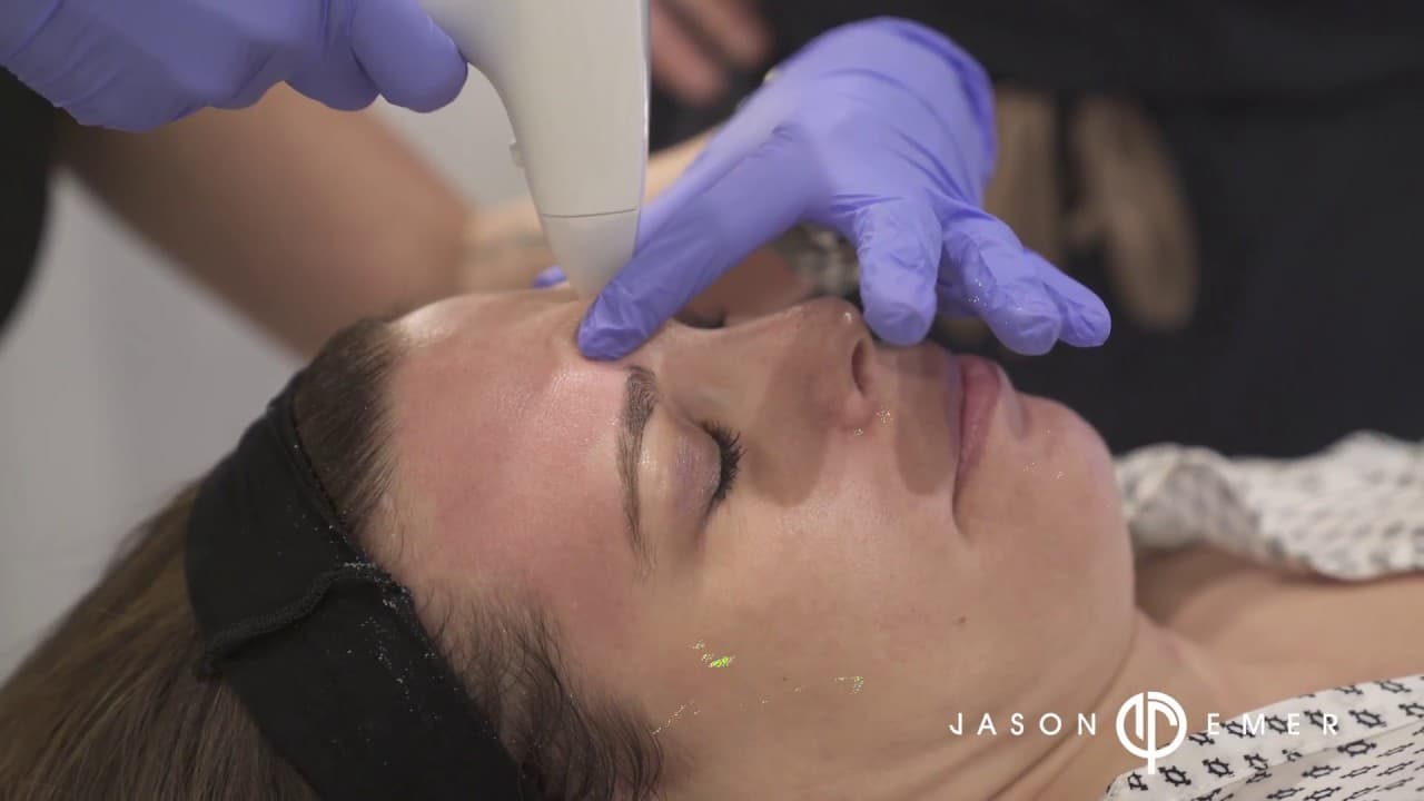Watch a pore treatment procedure video