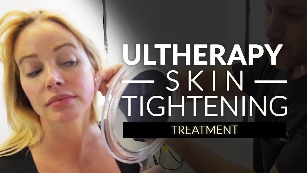Watch a non-surgical fat reduction & skin tightening procedure video