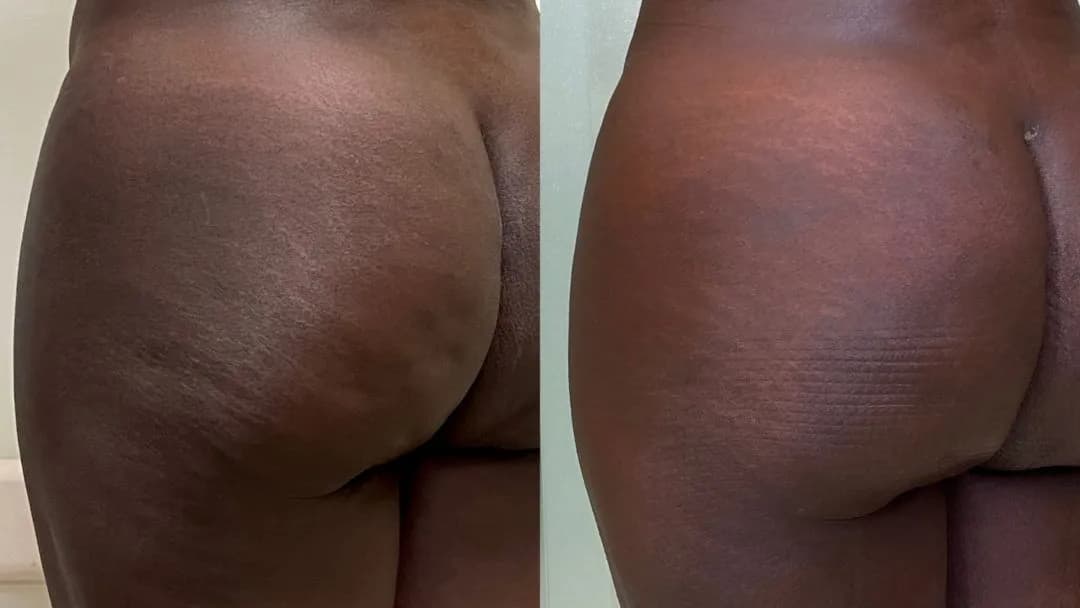 Patient before and after