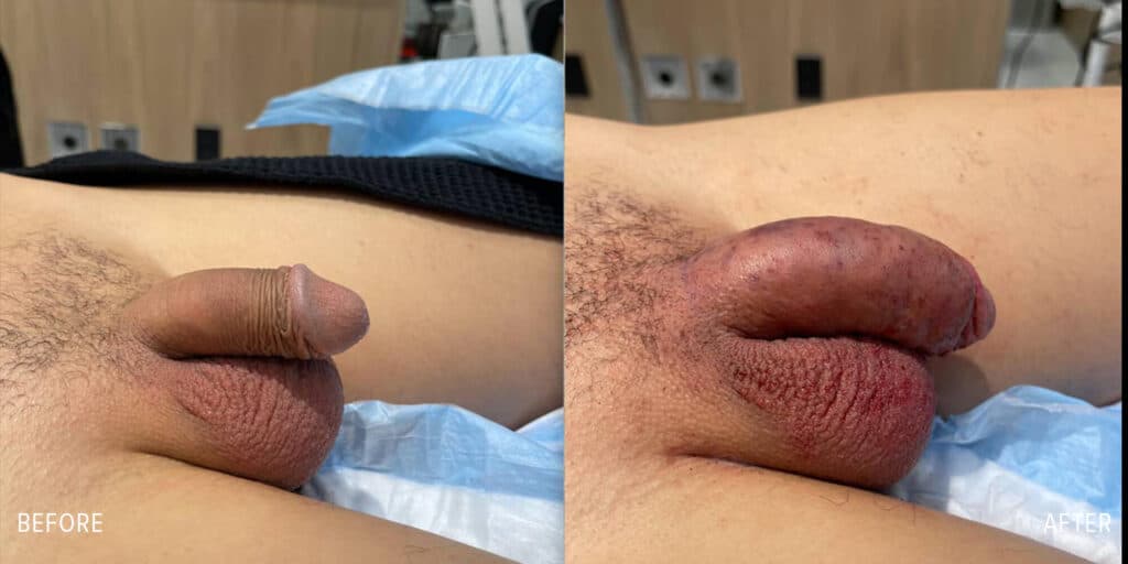 Patient before and after